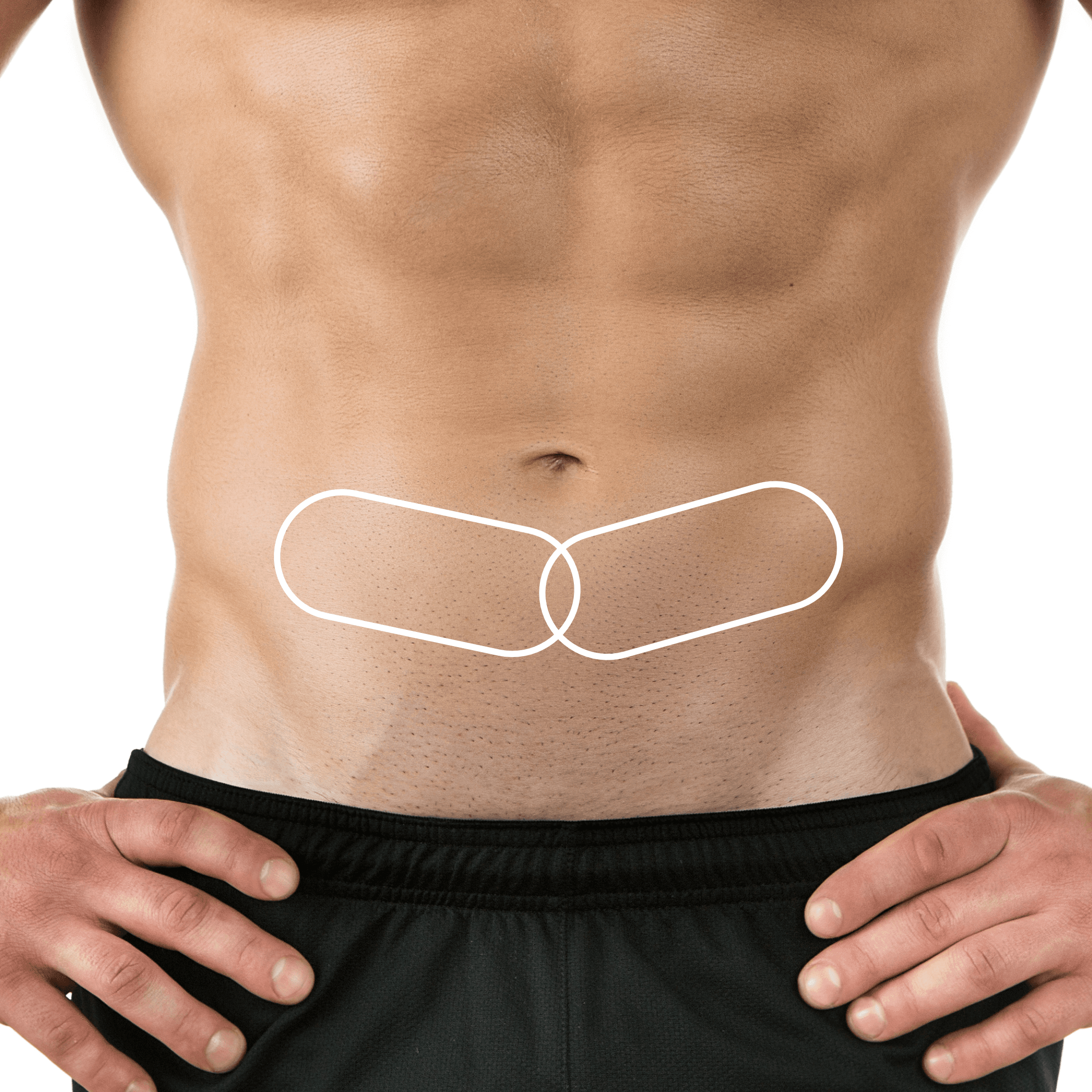 CoolSculpting treatment session